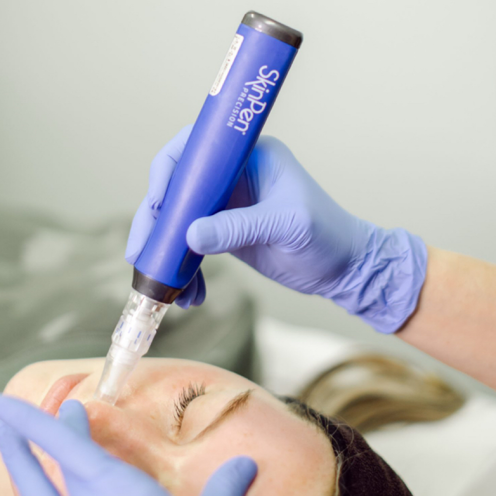 SkinPen Microneedling at Nurse Lab Aesthetics & Wellness in Mission, TX