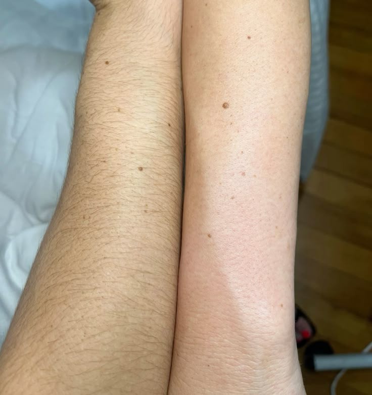 Full Arm Wax at Haus Of Skin in Burleson, TX