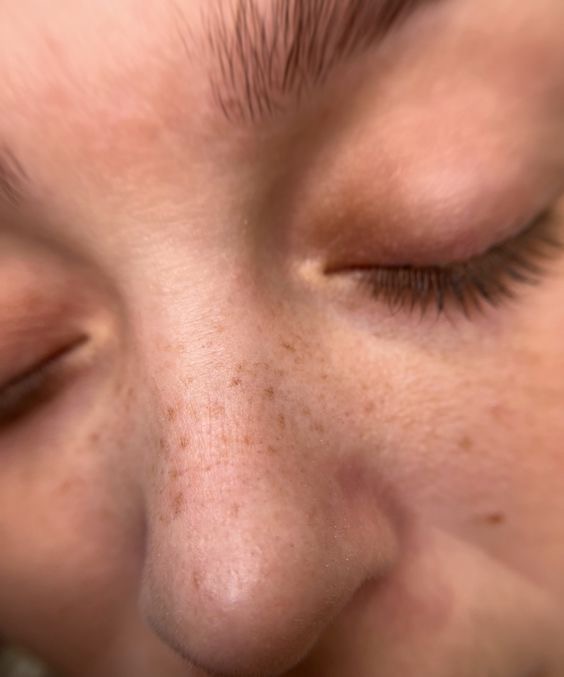 Faux Freckles