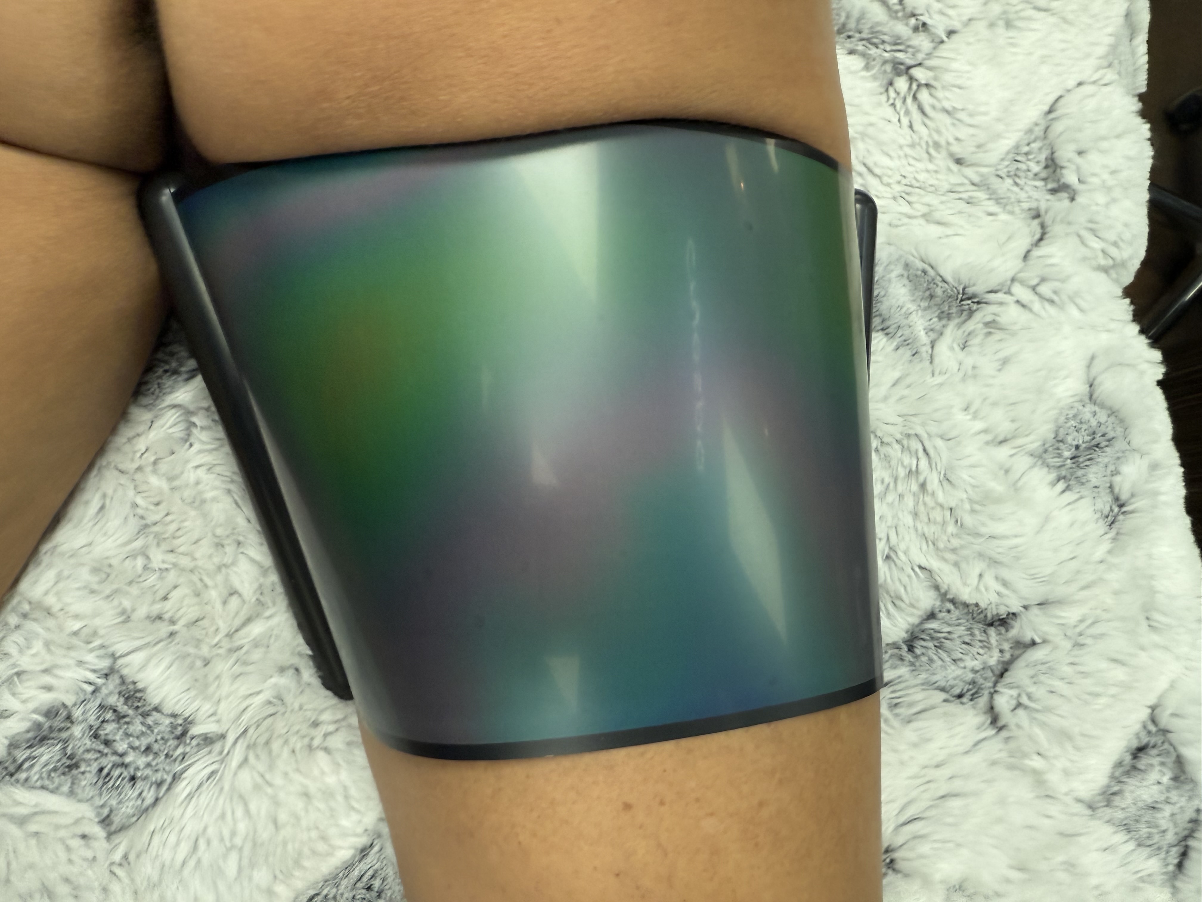 Cellulite Reduction