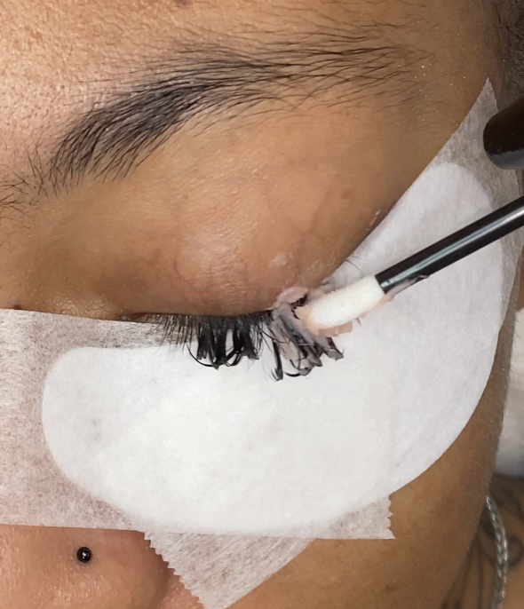 Eyelash Removal