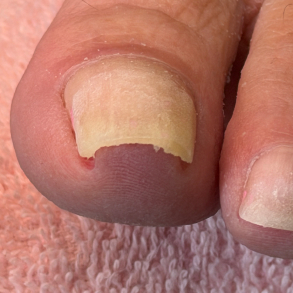 Toenail Trim at The Heel Hustler X Sarah B’s HairPlay in Laurel, MS
