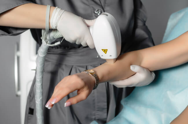 Laser Hair Removal: Forearms