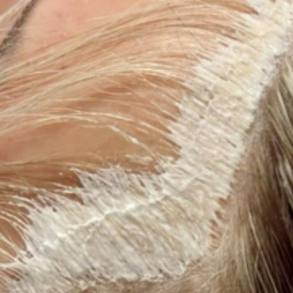Scandanavian Hairline Add On at SK Transformations in Tacoma, WA