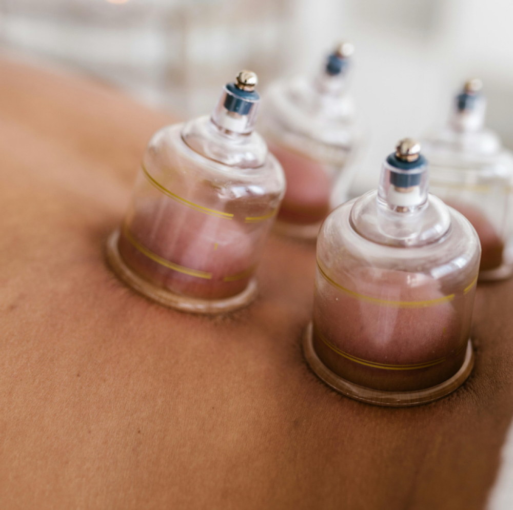 Cupping Therapy at Remedy Restorative Wellness in Wilmington, DE