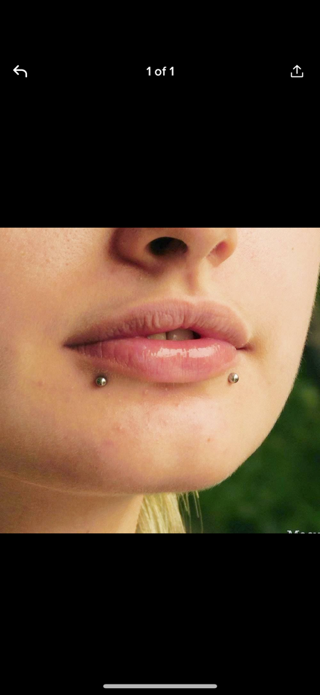 Snake Bites