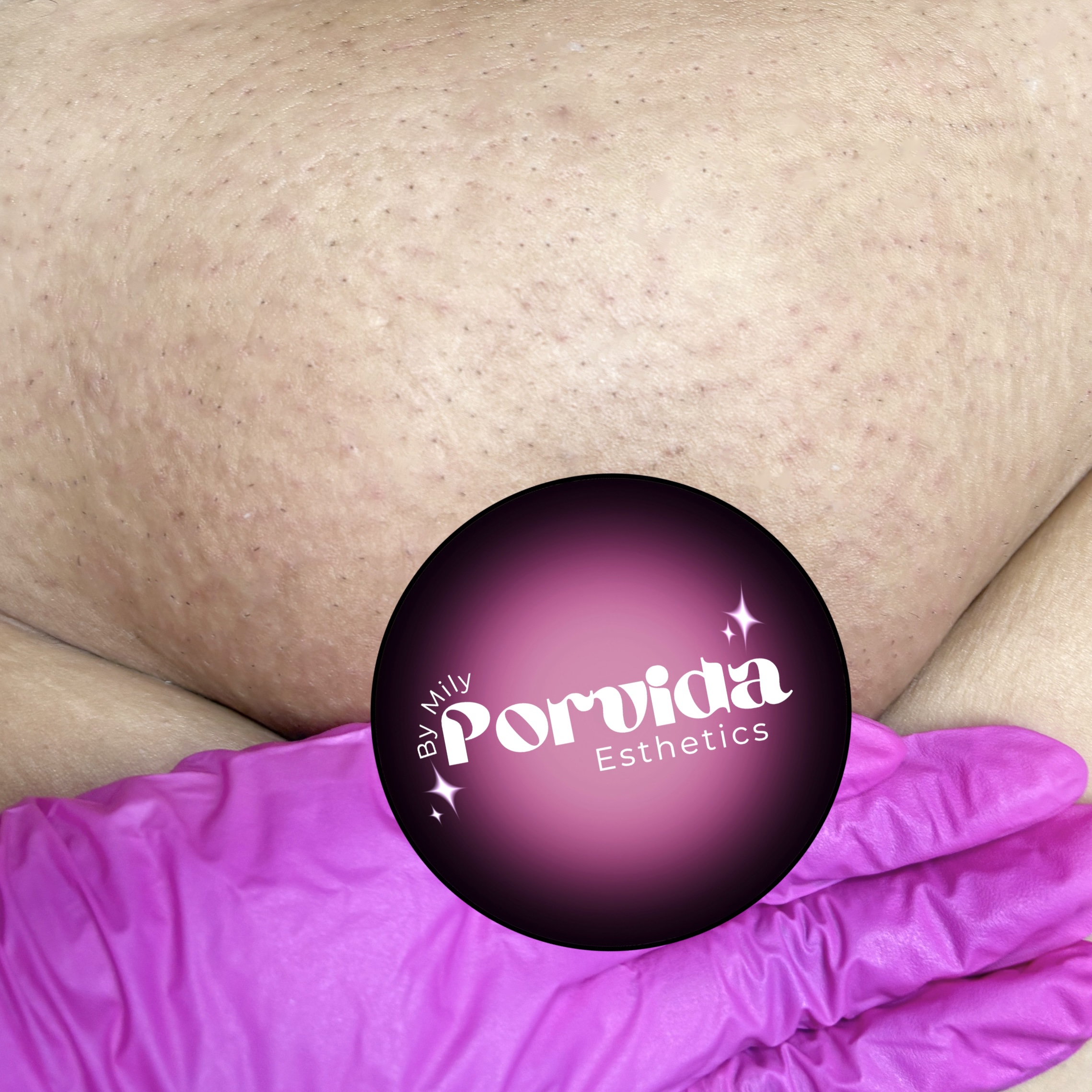 Brazilian Wax at Born Beaute in Mission, TX