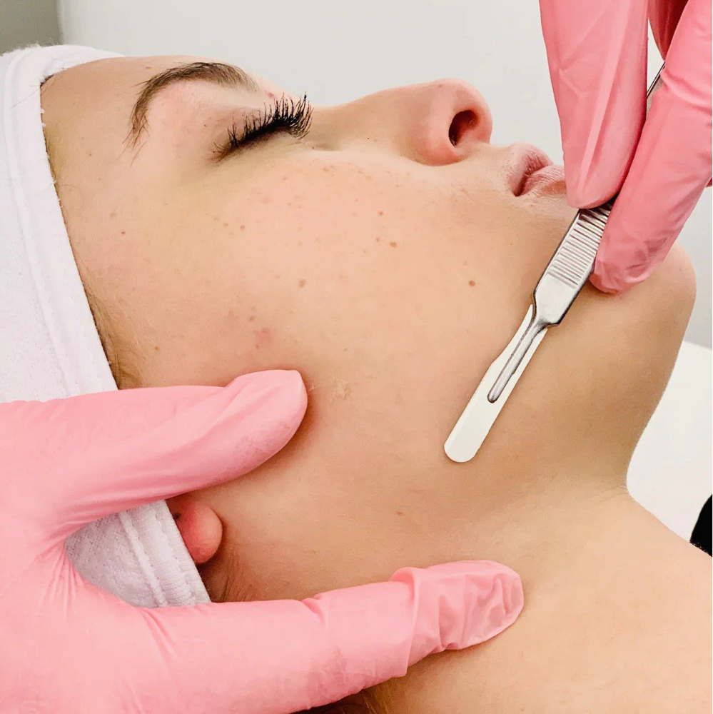 Dermaplaning -Add On