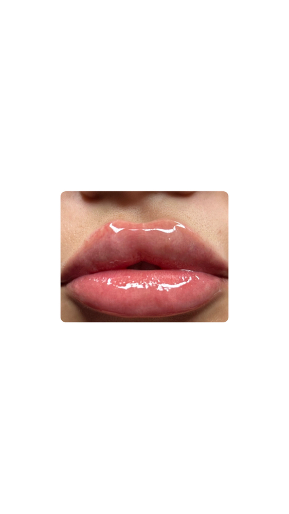 PACKAGE 1 (2ML TOTAL)