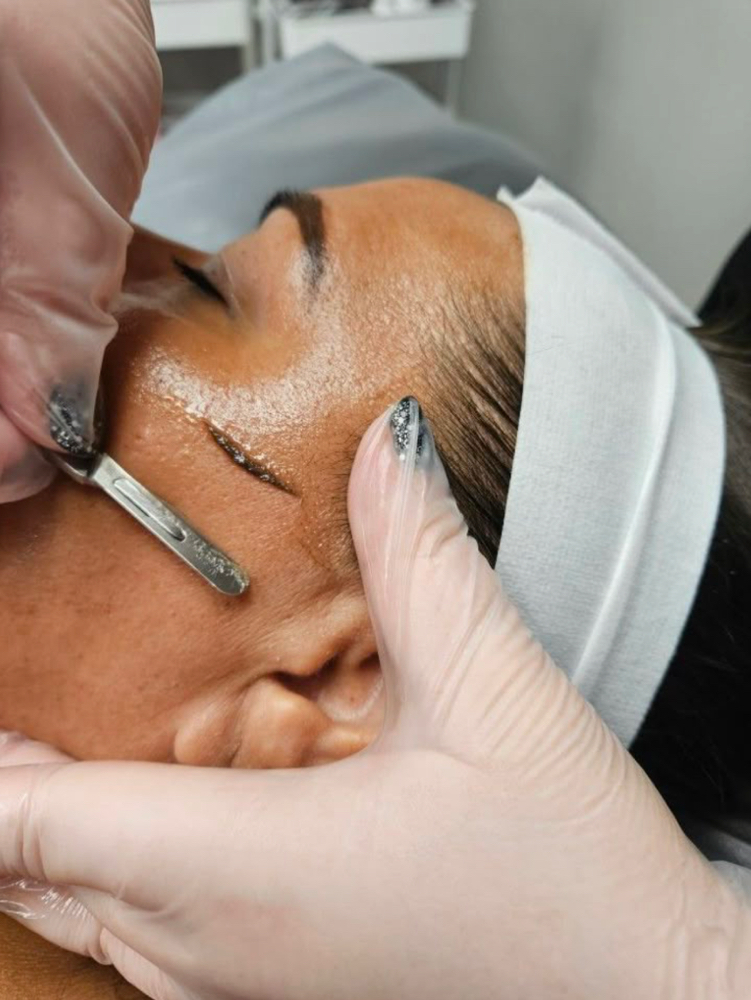 Dermaplane Facial