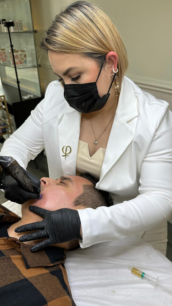 Microneedling