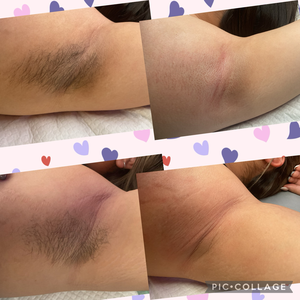 Underarm Waxing at Radiant Beauty in Alice, TX