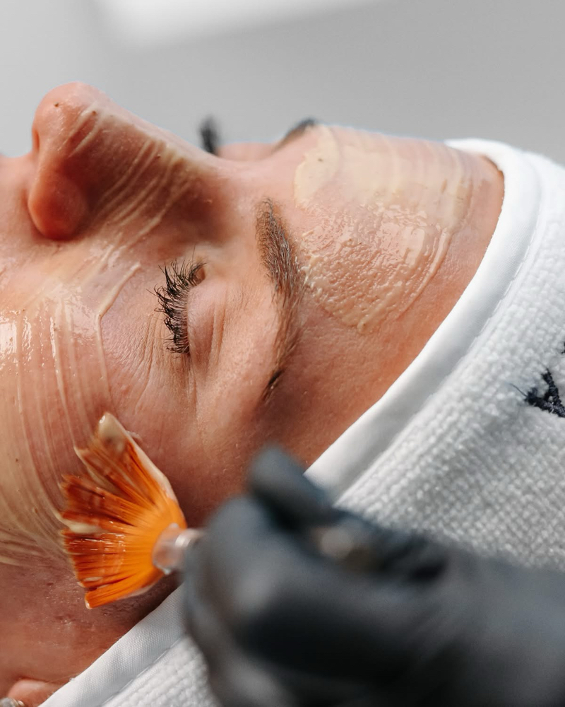 Renewal Acid Peel Facial