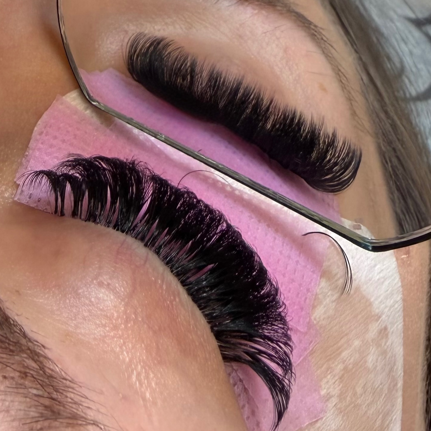 Forgein Fill at Ooh la la Aesthetics in Amarillo, TX