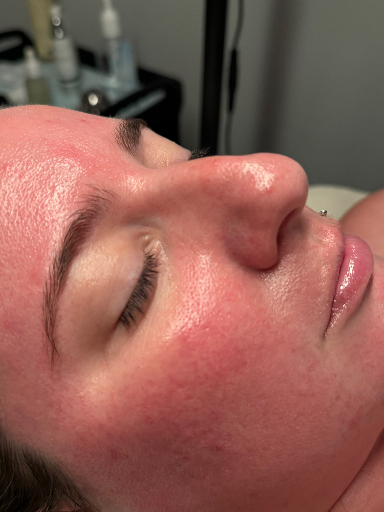 Custom Facial Special
