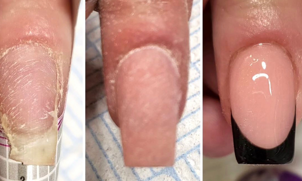 Nail Fix