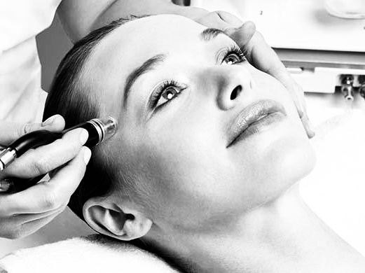 Silk Peel Facial