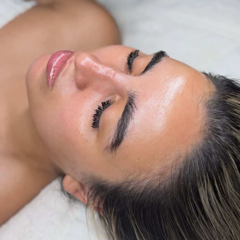 Enzymatic Pineapple Facial at Acnessia Laser Clinic in Guaynabo, PR