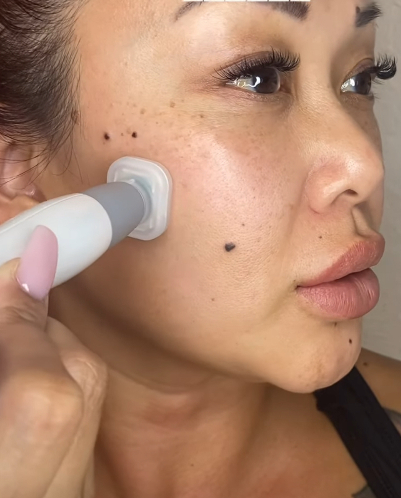 Jet Plasma at Signature Skin Spa in Scottsdale, AZ