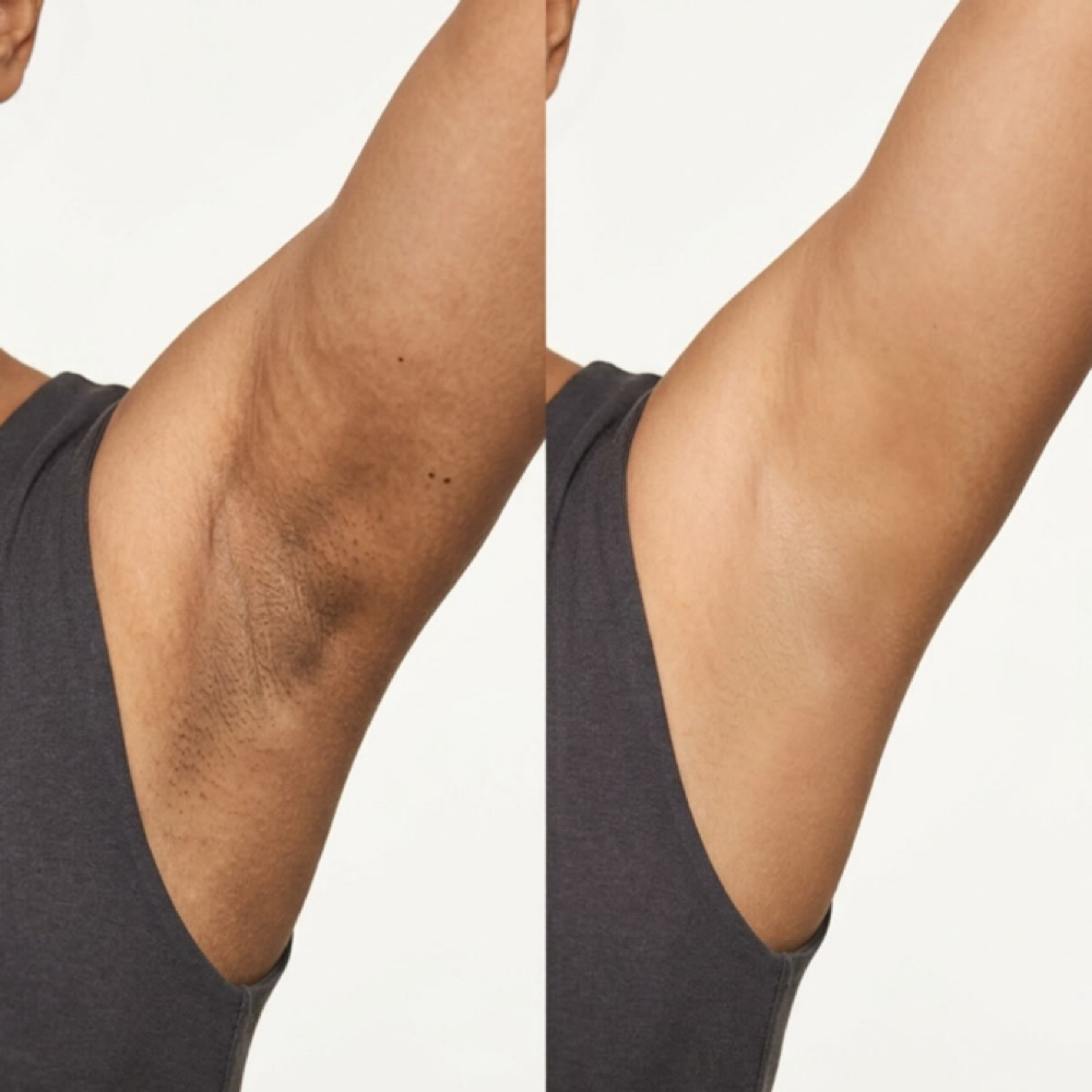 Underarms Wax at Au Naturale Luxe in York, PA