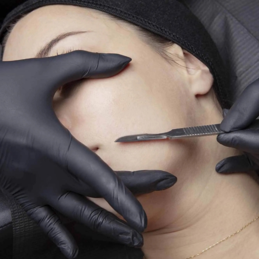 Dermaplaning Facial at Beautyfull Esthetics in Riverside, CA