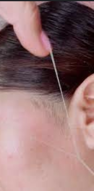 Sideburns Threading