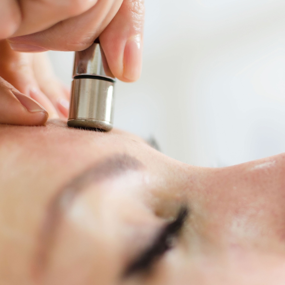 Microdermabrasion Facial