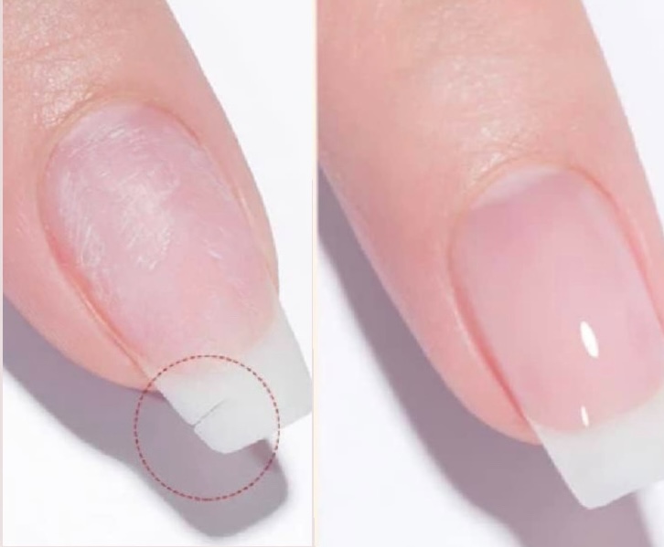 Add On Nail Repair