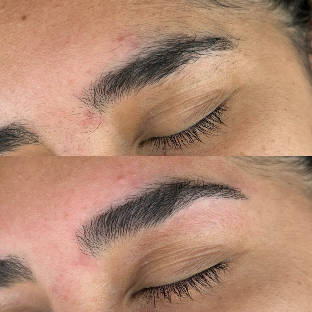 brow shaping