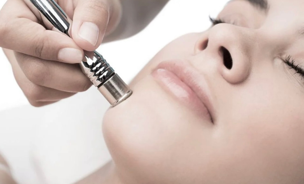 Facial Diamond Microdermabrasion