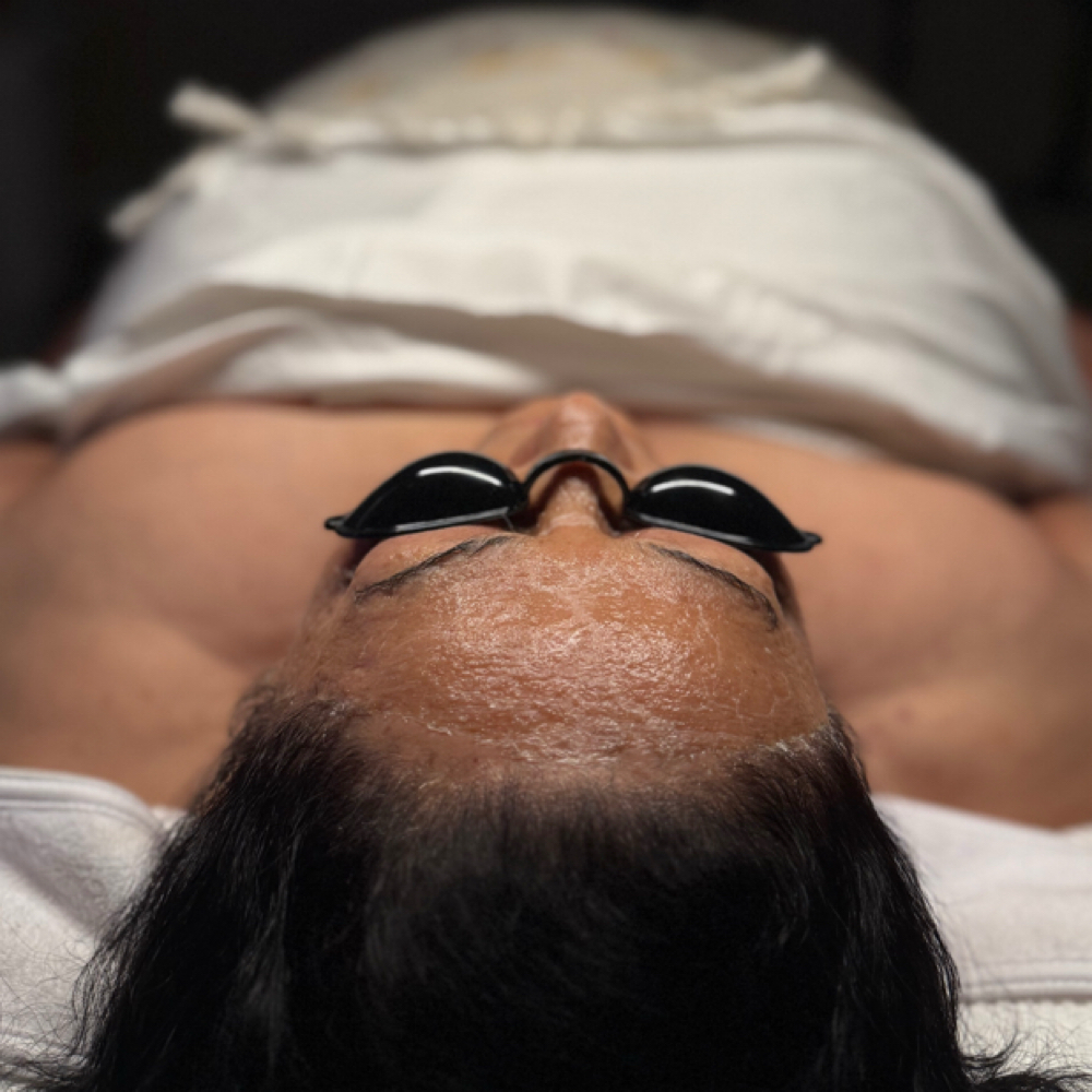 Peptide Firm & Glow Facial at Inclusive Esthetixs in CA, CA