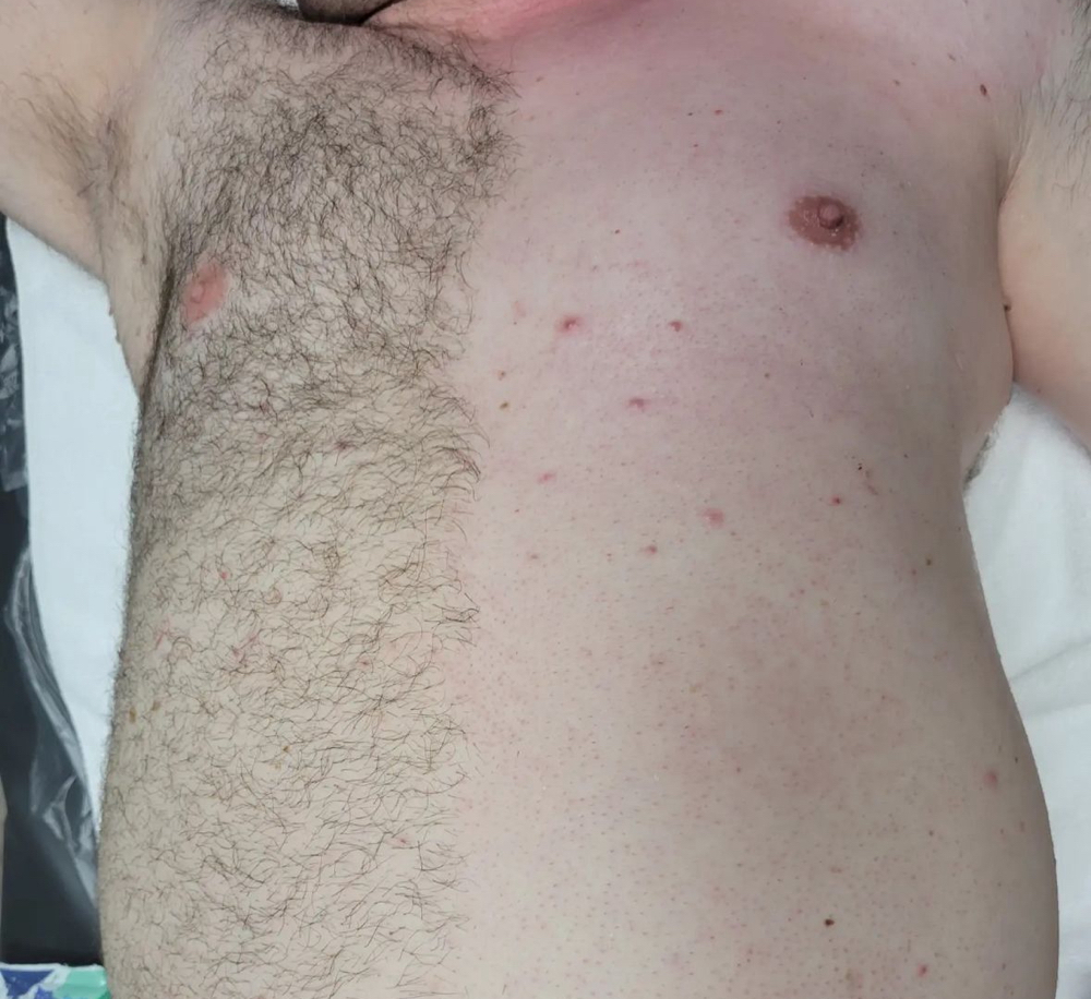 Full Chest Wax (Male)