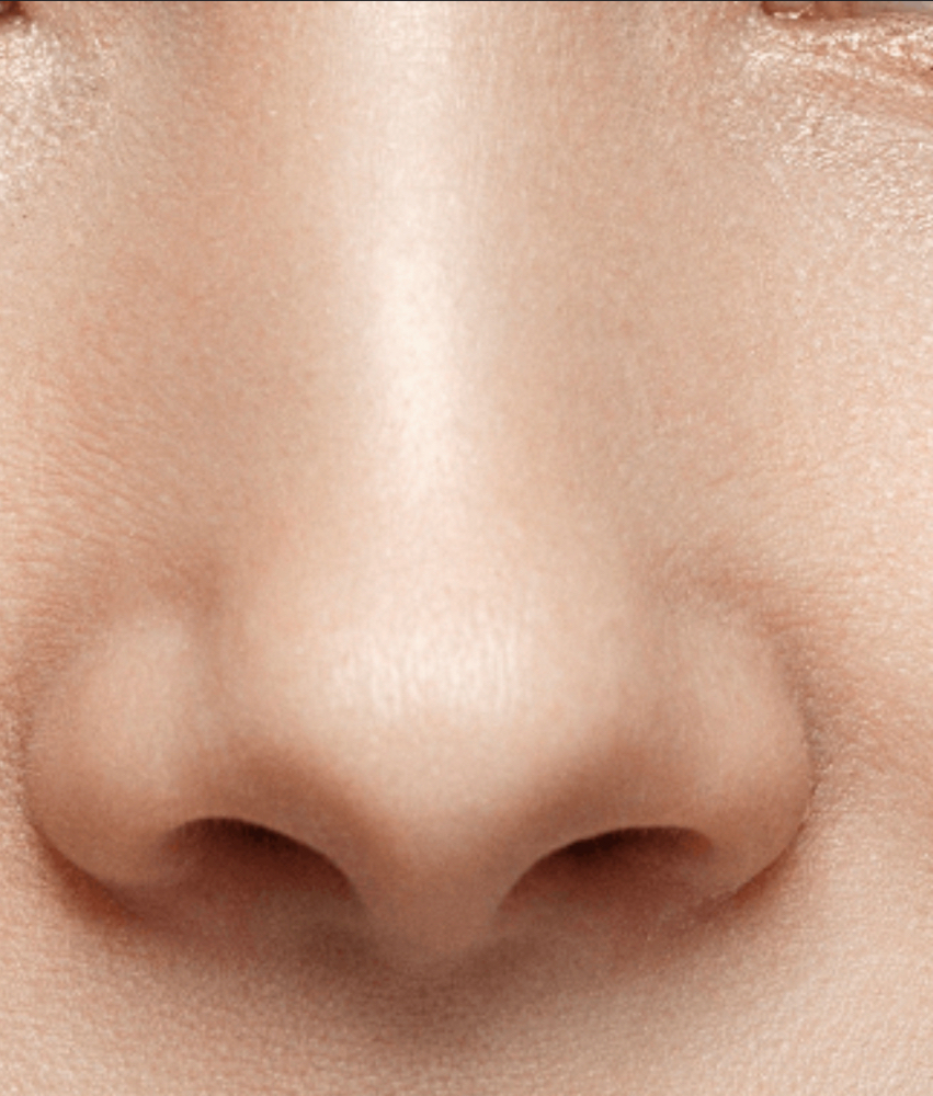Nose