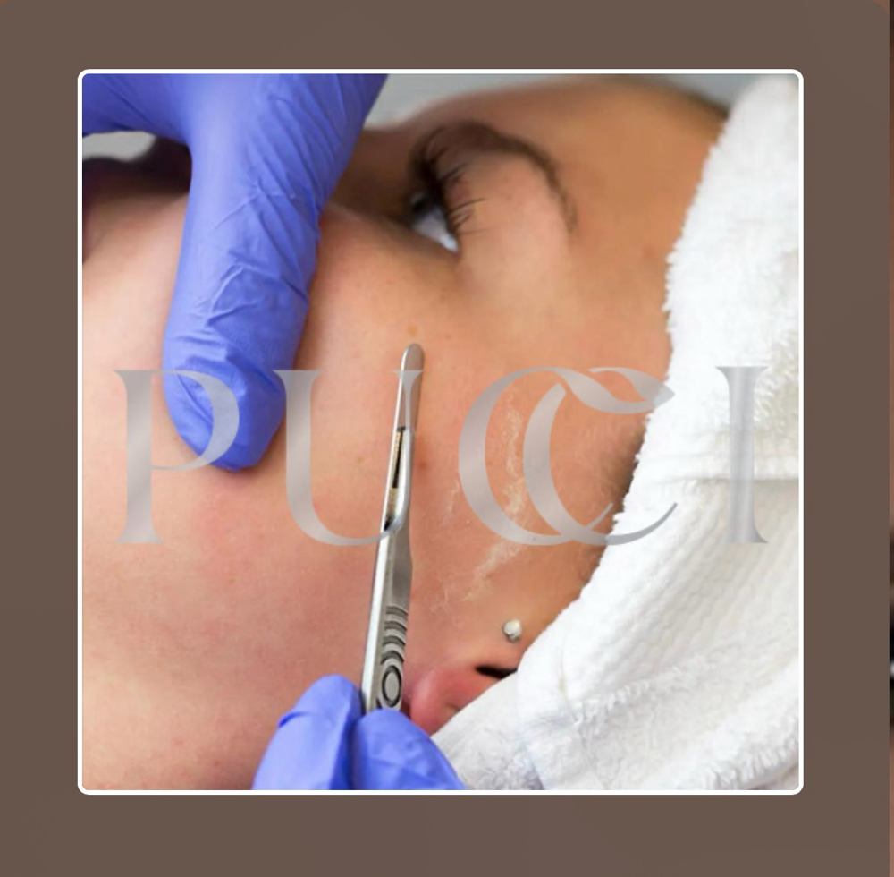 Pro Clinical Peel + Dermaplaning