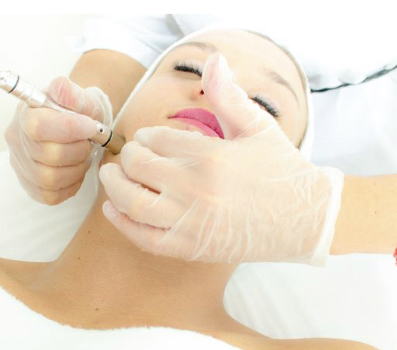 Custom Enzyme + Microdermabrasion