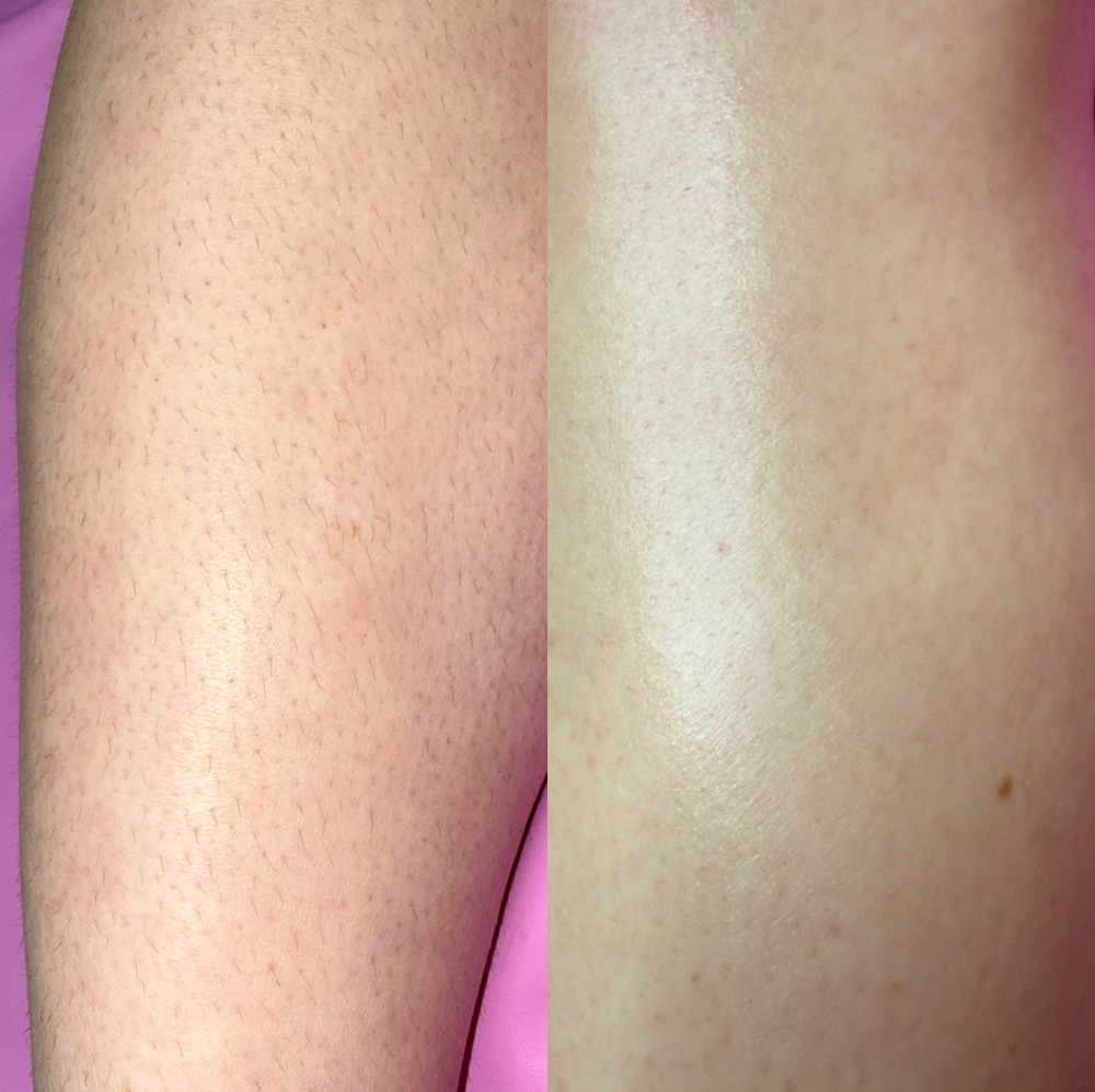 Full Leg Wax at Skin Lab by Ava Castelluzzo in Lapeer, MI