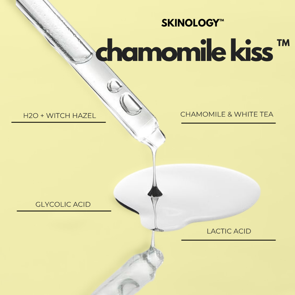 Chamomile Kiss™