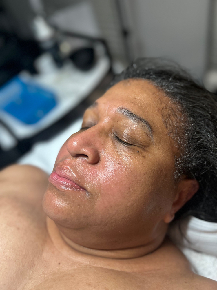 Menopausal Facial Package 4 Facials