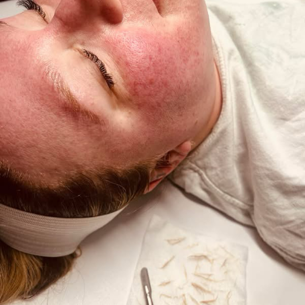Dermaplane w/ Facial Massage at You Time in Clarksville, TN
