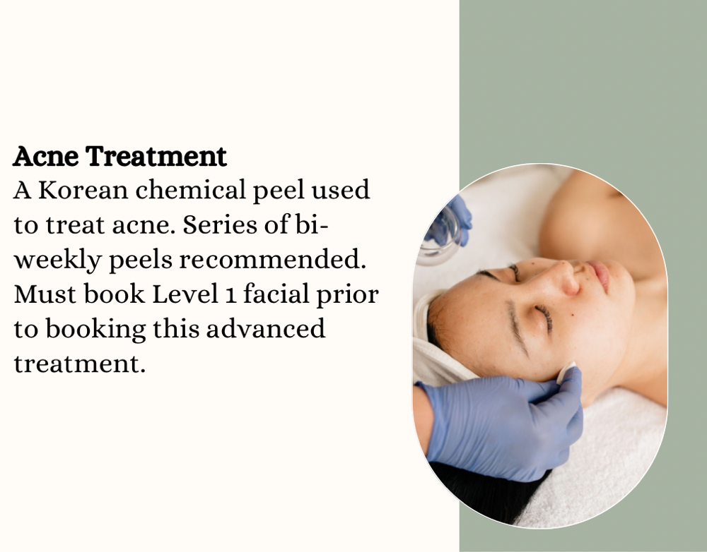 Acne Treatment