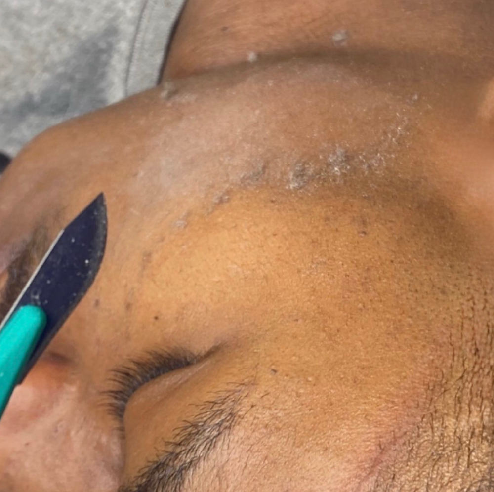 Dermaplane Facial at Brandish Glamour XVII Limited in Maple Heights, OH
