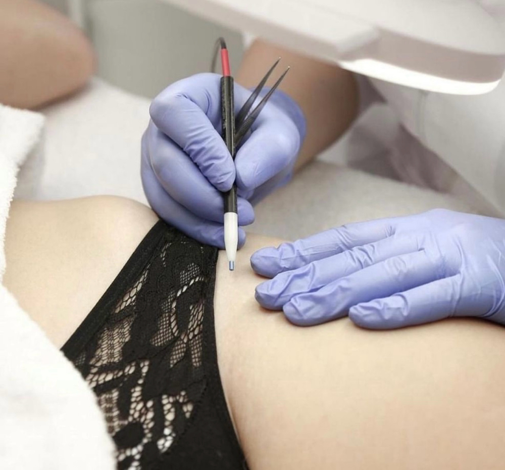 Electrolysis Long Session 3h+/95$h