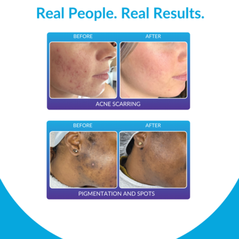 Procell Bundle Series