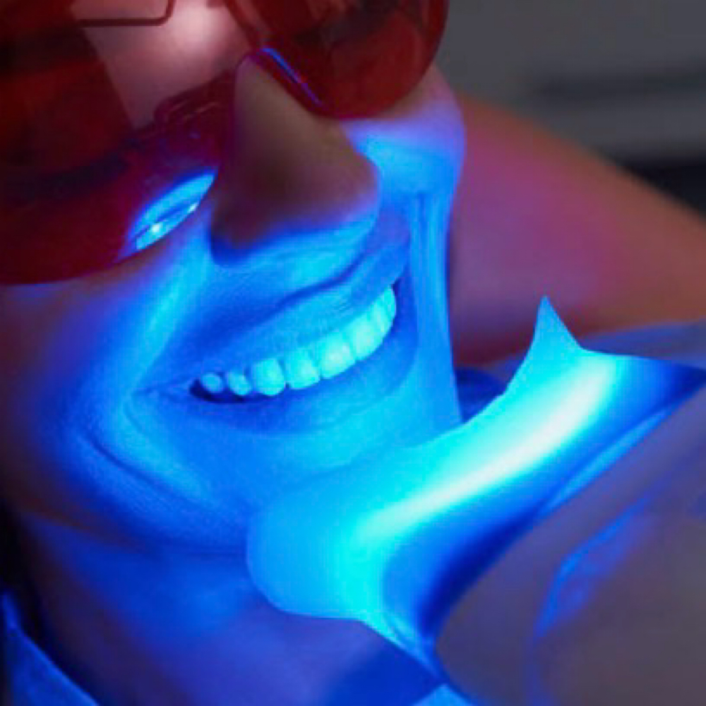 Smile Refinement Ritual at VXN Esthetics in Richardson, TX