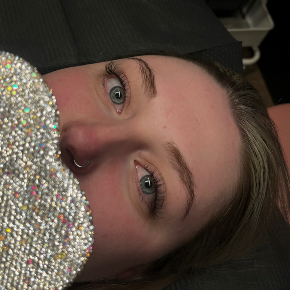 Classic Fill at Esthetics by Emma in Barberton Ohio, OH