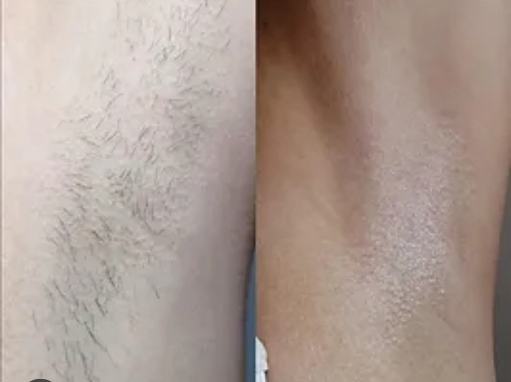 Under arm wax