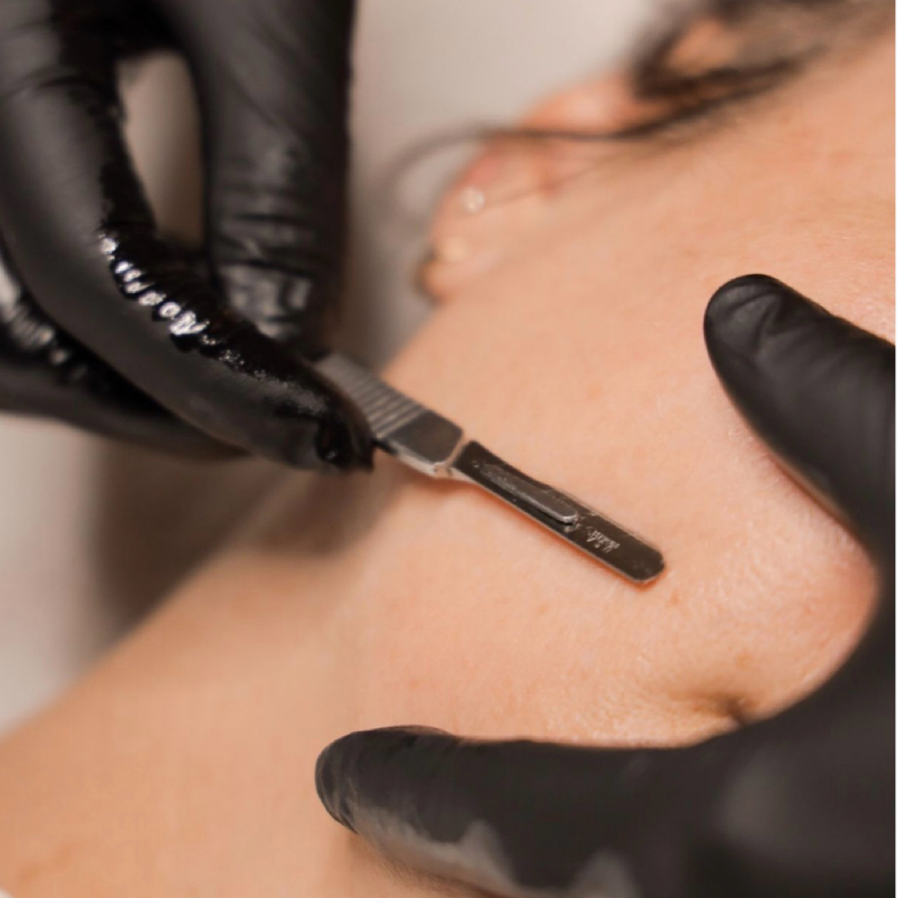 Dermaplane at SKN by madison in Central Point, OR