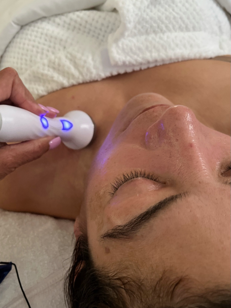 Radio Frequency Skin Tightening Ful