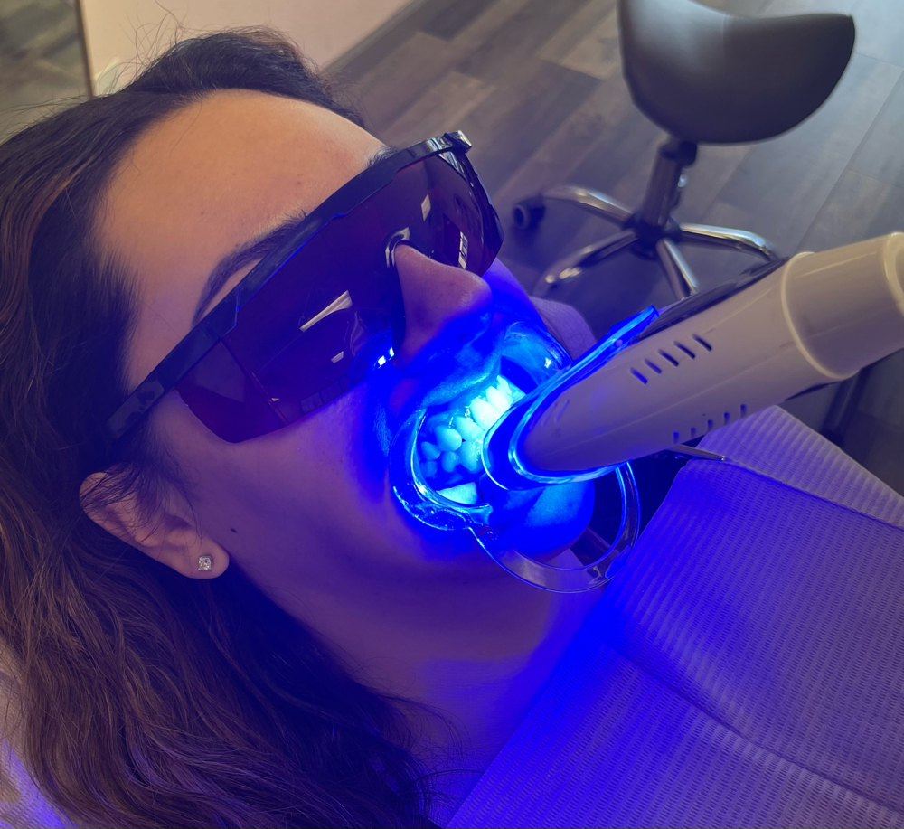 Teeth Whitening (Package Of 4)