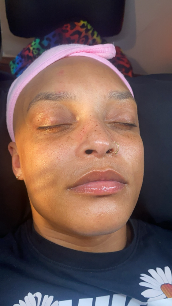 Customized Facial
